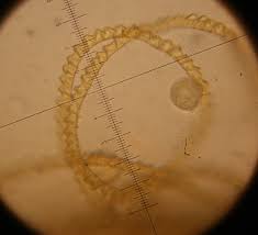 Attēlu rezultāti vaicājumam “Trichia varia sessile”