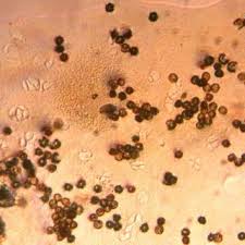 Attēlu rezultāti vaicājumam “Hemitrichia serpula spores”