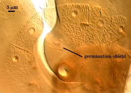 Attēlu rezultāti vaicājumam “Lycogala persicum spores”
