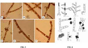Attēlu rezultāti vaicājumam “Trentepohlia sp.”