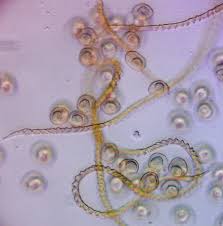 Attēlu rezultāti vaicājumam “Trichia longipalpis spores”