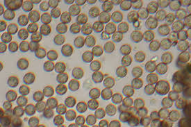 Attēlu rezultāti vaicājumam “Cribraria argillacea spores”