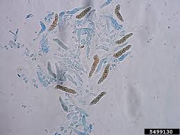 Attēlu rezultāti vaicājumam “Mycosphaerella ulmi”