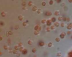 Attēlu rezultāti vaicājumam “Mucronella bresadolae”