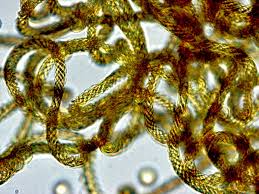 Attēlu rezultāti vaicājumam “Hemitrichia calyculata spores”