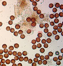 Attēlu rezultāti vaicājumam “Badhamia lilacina var. megaspora sessile”
