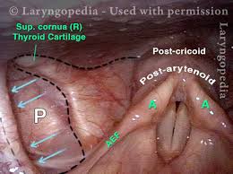 Attēlu rezultāti vaicājumam “Cribraria piriformis”