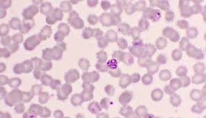 Attēlu rezultāti vaicājumam “Cribraria purpurea plasmodium”