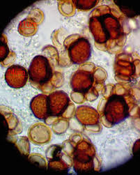 Attēlu rezultāti vaicājumam “Octospora splachnophila spores”