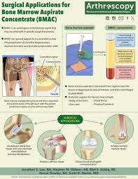 Image result for BMAC