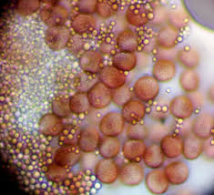 Attēlu rezultāti vaicājumam “Lycogala paraconfusum macro”