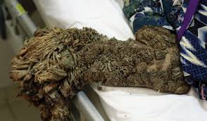 Image result for Lewandowsky-Lutz