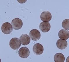 Attēlu rezultāti vaicājumam “Badhamia panicea spores”