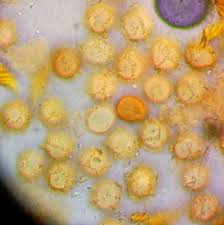 Attēlu rezultāti vaicājumam “Lycogala fuscoolearium young”