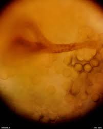 Attēlu rezultāti vaicājumam “Lycogala ustulatum macro”