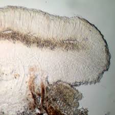 Attēlu rezultāti vaicājumam “Bacidia rubella”