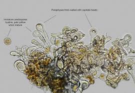 Attēlu rezultāti vaicājumam “Melampsora epitea”