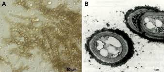 Attēlu rezultāti vaicājumam “Physarum straminipes spores”