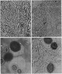 Attēlu rezultāti vaicājumam “Tubifera applanata spores”