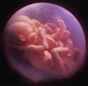 Womb