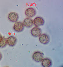 Attēlu rezultāti vaicājumam “Paradiacheopsis rigida spores”