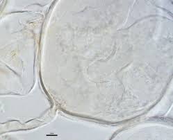 Attēlu rezultāti vaicājumam “Stemonaria irregularis spores”