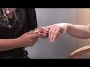 Hangnail