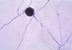 File:Aspergillus niger 01.jpg - Wikipedia, the free encyclopedia