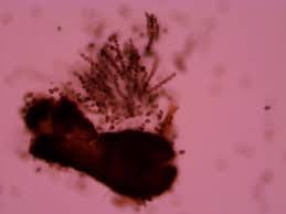 Attēlu rezultāti vaicājumam “Sordaria fimicola”