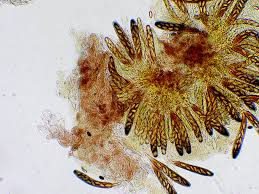 Attēlu rezultāti vaicājumam “Ascobolus furfuraceus”