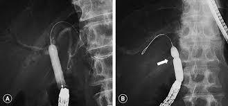 Image result for 뺾