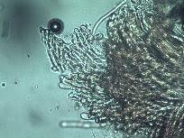 Attēlu rezultāti vaicājumam “Octospora splachnophila spores”