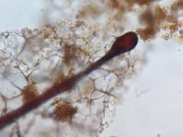 Attēlu rezultāti vaicājumam “Stemonitis flavogenita”