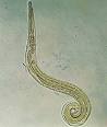 The parasite, <b>Enterobius</b>