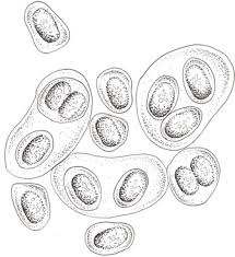 Attēlu rezultāti vaicājumam “Gloeocapsa rupestris”