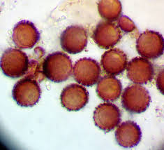 Attēlu rezultāti vaicājumam “Badhamia flavoglauca sessile”