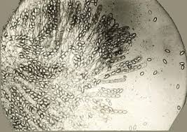 Attēlu rezultāti vaicājumam “Lycogala botrydium spores”