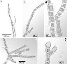 Attēlu rezultāti vaicājumam “Trentepohlia sp.”