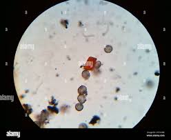 Attēlu rezultāti vaicājumam “Physarum psittacinum spores”