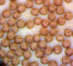 Attēlu rezultāti vaicājumam “Diderma deplanatum spores”