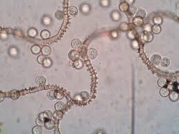 Attēlu rezultāti vaicājumam “Arcyria affinis”