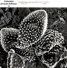 Attēlu rezultāti vaicājumam “Tranzschelia pruni-spinosae spores”