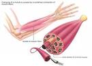 Muscle <b>Spasm</b>