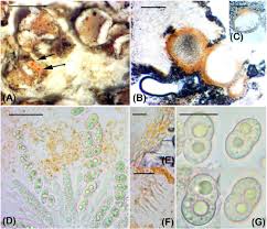 Attēlu rezultāti vaicājumam “Lichenoconium xanthoriae”