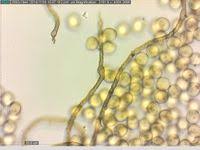 Attēlu rezultāti vaicājumam “Trichia contorta”