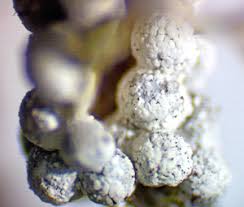 Attēlu rezultāti vaicājumam “Diderma spumarioides plasmodium”