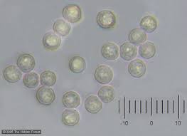 Attēlu rezultāti vaicājumam “Arcyria cinerea stalked”