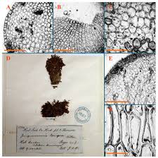 Attēlu rezultāti vaicājumam “Jungermannia hyalina cells”