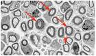 UK Glial Cell Club « UCL Research Department of Cell and ...