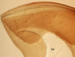 Attēlu rezultāti vaicājumam “Licea castanea spores”
